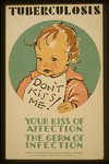 WPA Poster: Tuberculosis Don't kiss me! : Your kiss of affection - the germ of infection